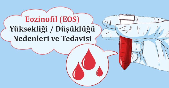 Eozinofil Yüksekliği Nedir?